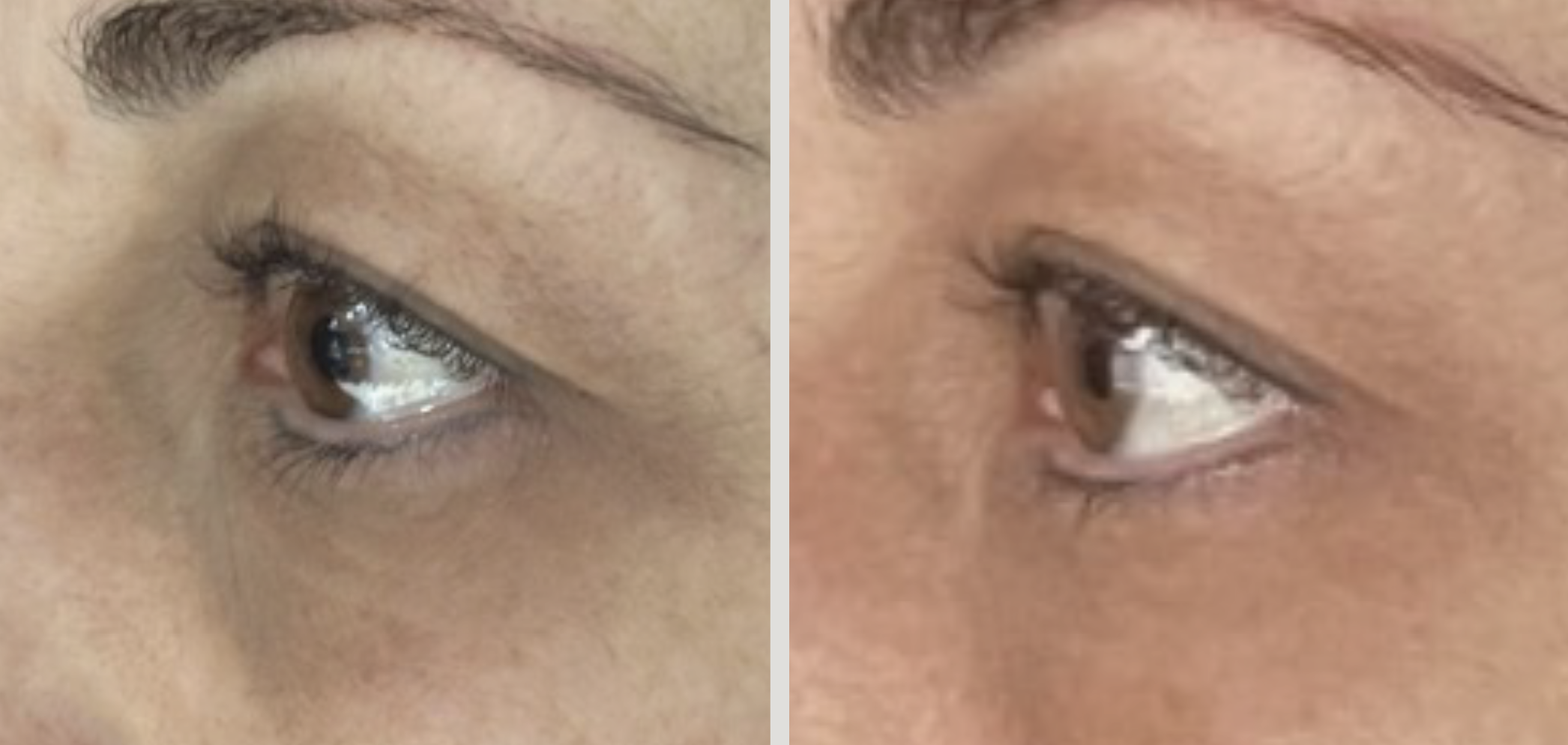 Scherm­afbeelding 2025 08 15 om 15.14.11