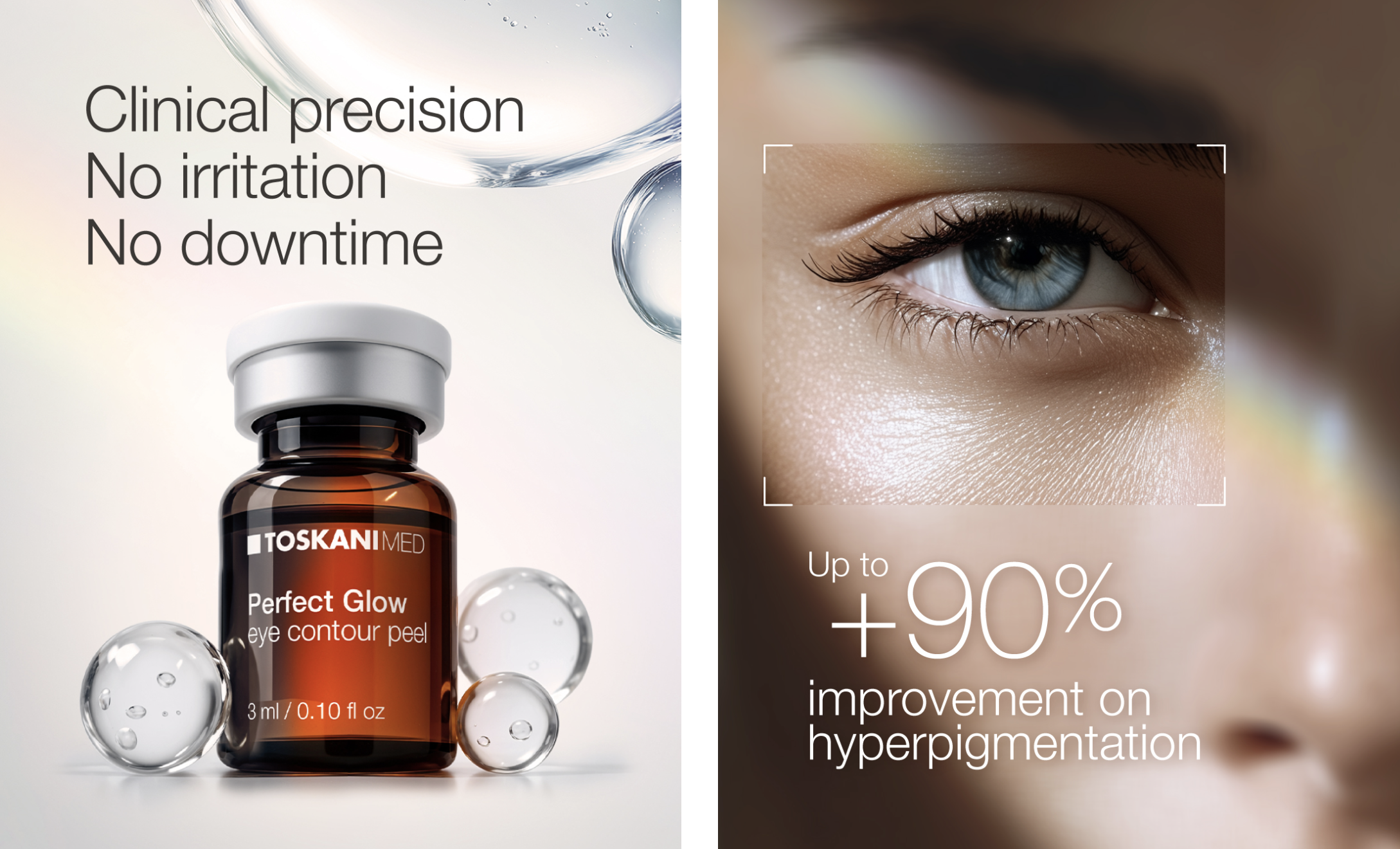 PERFECT GLOW eye contour peel
